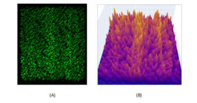 Figure 3. Epsilon’s skin capacitance 2D image (A) and the Dermalyser 3D display (B).